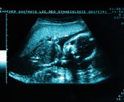 ultrasound_consulting